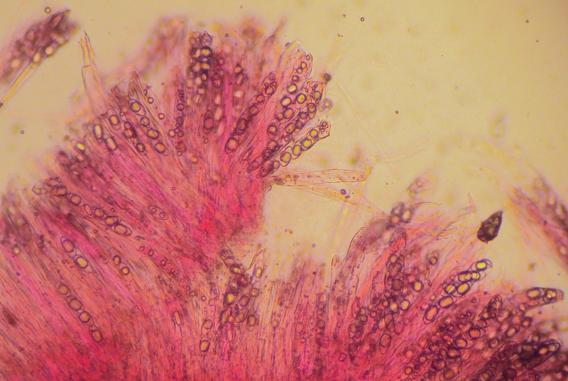 Ascomicete da determinare con microscopia 15.01.10.